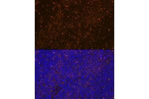 Immunofluorescence analysis of mouse spleen using WASP Rabbit mAb (ABIN7271381) at dilution of 1:100 (40x lens).