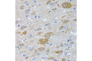 Immunohistochemistry of paraffin-embedded rat brain using EIF2S3 antibody (ABIN5975415) at dilution of 1/100 (40x lens). (EIF2S3 anticorps)