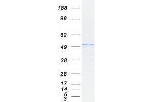 Validation with Western Blot