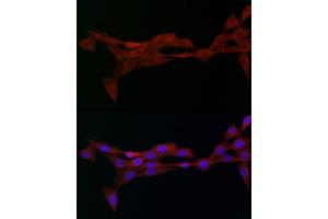 Immunofluorescence analysis of NIH/3T3 cells using Alph-adaptin/ Rabbit pAb (ABIN6130980, ABIN6136955, ABIN6136957 and ABIN6221039) at dilution of 1:50 (40x lens).