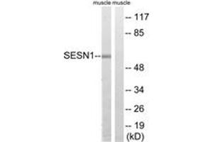 Western Blotting (WB) image for anti-Sestrin 1 (SESN1) (AA 271-320) antibody (ABIN2890629) (SESN1 anticorps  (AA 271-320))