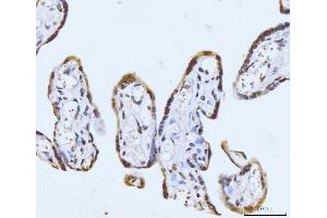 IHC analysis of GHITM using anti-GHITM antibody (ABIN7599294). (GHITM anticorps  (AA 1-345))