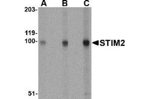 Western Blotting (WB) image for anti-Stromal Interaction Molecule 2 (Stim2) (Middle Region) antibody (ABIN1031110) (Stim2 anticorps  (Middle Region))