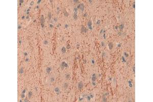 Used in DAB staining on fromalin fixed paraffin- embedded brain tissue