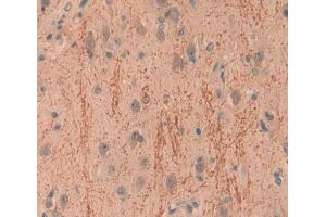 Used in DAB staining on fromalin fixed paraffin- embedded brain tissue (INPP4A anticorps  (AA 1-137))