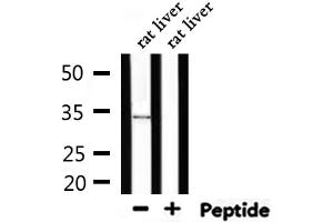 Western blot analysis of extracts from rat liver, using MyD88 Antibody. (MYD88 anticorps)