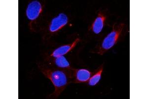 IF analysis of DDX4 using anti-DDX4 antibody (ABIN7601203). (DDX4 anticorps  (AA 3-666))