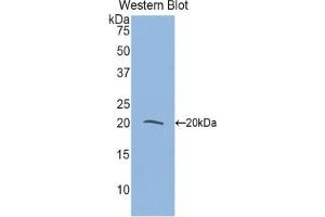 Western blot analysis of the recombinant protein. (MYL9 anticorps  (AA 5-163))