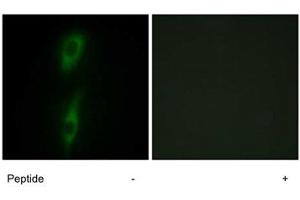 Immunofluorescence analysis of HeLa cells, using ACVRL1 polyclonal antibody . (ACVRL1 anticorps)
