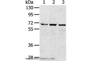 Western blot analysis of 293T, hepg2 and A172 cell, using SLC5A9 Polyclonal Antibody at dilution of 1:300 (SLC5A9 anticorps)