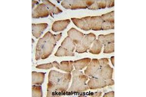 Formalin-fixed and paraffin-embedded human skeletal muscle reacted with T150A Antibody (Center), which was peroxidase-conjugated to the secondary antibody, followed by DAB staining. (TMEM150A anticorps  (Middle Region))