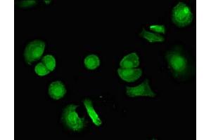 Immunofluorescent analysis of MCF-7 cells using ABIN7175320 at dilution of 1:100 and Alexa Fluor 488-congugated AffiniPure Goat Anti-Rabbit IgG(H+L)