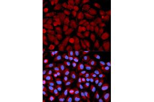 Immunofluorescence analysis of U2OS cells using MAPK9 antibody. (JNK2 anticorps)
