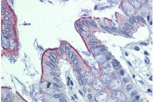 Human Colon: Formalin-Fixed, Paraffin-Embedded (FFPE)