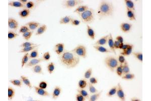 IHC analysis of BAK using anti-BAK antibody .