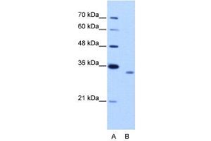 WB Suggested Anti-RBM4B  Antibody Titration: 2. (RBM4B anticorps  (C-Term))