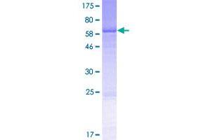 Image no. 1 for Ancient Ubiquitous Protein 1 (Aup1) (AA 1-410) protein (GST tag) (ABIN1346204)