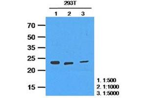 Western Blotting (WB) image for anti-Hypoxanthine phosphoribosyltransferase 1 (HPRT1) antibody (ABIN781535) (HPRT1 anticorps)