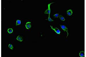 Immunofluorescent analysis of MCF-7 cells using ABIN7164909 at dilution of 1:100 and Alexa Fluor 488-congugated AffiniPure Goat Anti-Rabbit IgG(H+L) (ADRM1 anticorps  (AA 2-407))
