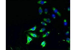 Immunofluorescent analysis of A549 cells using ABIN7163341 at dilution of 1:100 and Alexa Fluor 488-congugated AffiniPure Goat Anti-Rabbit IgG(H+L) (Phospholipase D4 anticorps  (AA 52-506))
