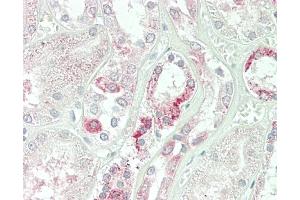Formalin-fixed and paraffin-embedded H.