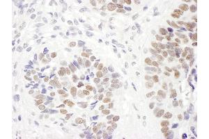 Immunohistochemistry (IHC) image for anti-MutS Homolog 6 (E. Coli) (MSH6) (AA 350-400) antibody (ABIN7454510) (MSH6 anticorps  (AA 350-400))
