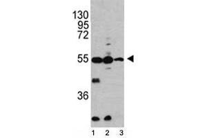 Western blot analysis of Caspase-2 antibody and 1) HL-60, 2) K562, 3) Ramos lysate.