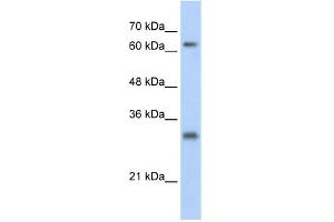 WB Suggested Anti-USP39 Antibody Titration:  0. (USP39 anticorps  (N-Term))