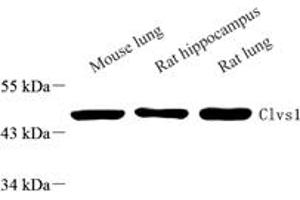 Western blot analysis of Clavesin 1 (ABIN7073517) at dilution of 1: 1000,Lane 1: Mouse lung tissue lysate,Lane 2: Rat ppocampus tissue lysate,Lane 3: Rat lung tissue lysate (Clavesin 1 anticorps)