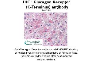 Image no. 1 for anti-Glucagon Receptor (GCGR) (C-Term) antibody (ABIN1734752) (Glucagon Receptor anticorps  (C-Term))