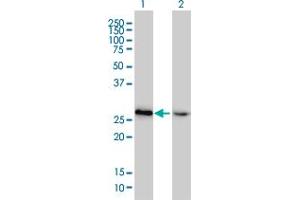 Western Blot analysis of HMGB2 expression in transfected 293T cell line by HMGB2 monoclonal antibody (M02), clone 4G7. (HMGB2 anticorps  (AA 1-195))