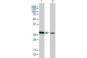 Western Blot analysis of HMGB2 expression in transfected 293T cell line by HMGB2 monoclonal antibody (M02), clone 4G7.