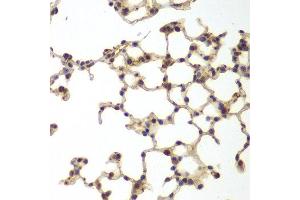 Immunohistochemistry of paraffin-embedded mouse lung using GSS antibody at dilution of 1:200 (400x lens).