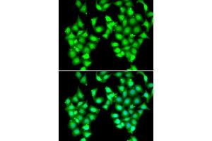 Immunofluorescence analysis of MCF7 cells using ATOH1 antibody.