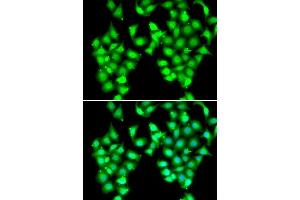 Immunofluorescence analysis of MCF7 cells using ATOH1 antibody. (ATOH1 anticorps  (AA 215-354))