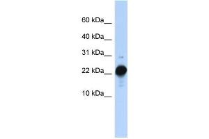 WB Suggested Anti-CSHL1 Antibody Titration:  0. (CSHL1 anticorps  (C-Term))