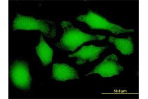Immunofluorescence of purified MaxPab antibody to PSMD9 on HeLa cell.