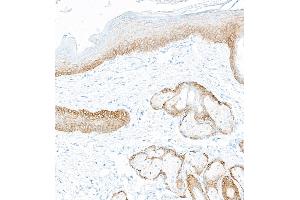 Immunohistochemistry (IHC) image for anti-Keratin 5 (KRT5) (C-Term) antibody (ABIN7795754)