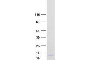 Validation with Western Blot