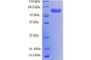 14-3-3 eta (YWHAH) (AA 4-246), (partial) protein (GST tag)