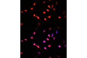 Immunofluorescence analysis of U2OS cells using KDM6B antibody (ABIN6131823, ABIN6142806, ABIN6142809 and ABIN6216507) at dilution of 1:100.