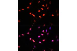 Immunofluorescence analysis of U2OS cells using KDM6B antibody (ABIN6131823, ABIN6142806, ABIN6142809 and ABIN6216507) at dilution of 1:100. (Kdm6b anticorps  (AA 265-450))
