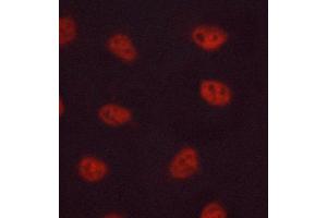 ABIN6268643 staining MCF-7 cells by ICC/IF.