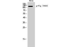 Western Blotting (WB) image for anti-Filaggrin (FLG) (pTyr654) antibody (ABIN3182416) (Filaggrin anticorps  (pTyr654))