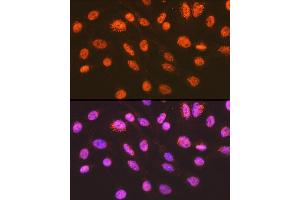 Immunofluorescence analysis of C6 cells using ENT2/SLC29 Rabbit mAb (ABIN7270448) at dilution of 1:100 (40x lens).