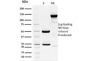 SDS-PAGE Analysis Purified HPV-18 Mouse Monoclonal Antibody (HPV16 E1/E4). (Human Papilloma Virus 16 E1, E4 (HPV-16 E1, E4) (AA 36-41) anticorps)