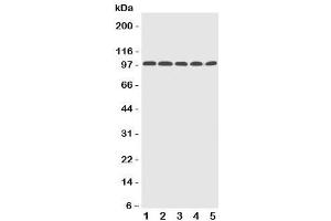 Western blot testing of Progesterone Receptor antibody and Lane 1: human HeLa