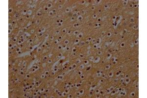 IHC image of ABIN7161274 diluted at 1:300 and staining in paraffin-embedded human brain tissue performed on a Leica BondTM system. (NEFH anticorps  (AA 825-1003))