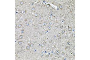 Immunohistochemistry of paraffin-embedded mouse brain using EIF3C Antibody.