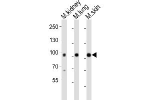 Western blot analysis of lysates from mouse kidney, mouse lung, mouse skin tissue (from left to right), using Epha1 Antibody (N-term) (ABIN6242303 and ABIN6577697). (EPHA1 anticorps  (N-Term))